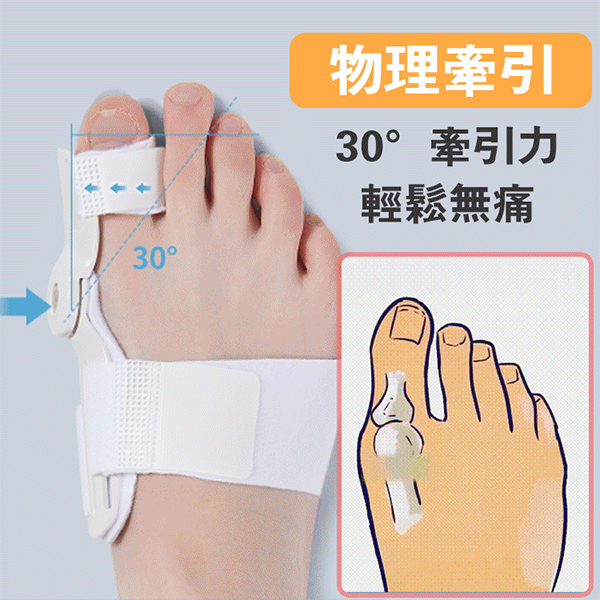 拇外翻矯正器 拇外翻矯正器